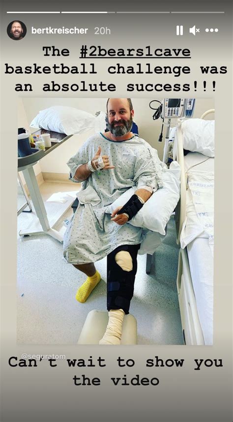 He was taken to the hospital where it was determined that he had a broken arm and leg. . Tom segura legs